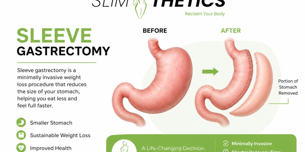 Sleeve Gastrectomy vs Gastric Band: Which Weight Loss Surgery Is Right for You?
