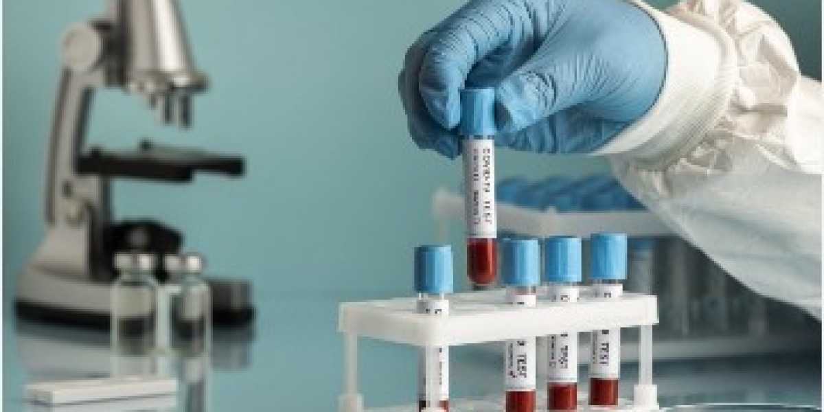 LFT Test Price in Lahore – Complete Guide to Liver Function Test, Benefits & Cost Factors (2026)