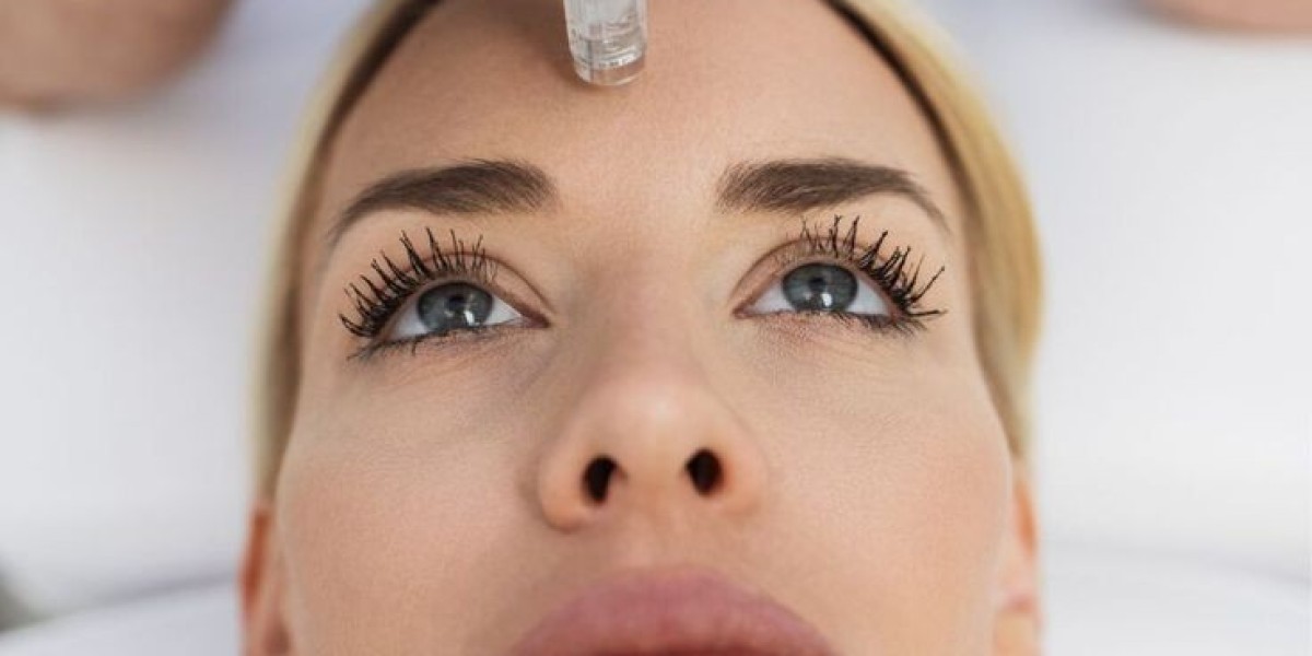 Is Microneedling with PRP in Dubai Worth Trying?