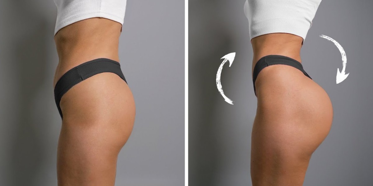 Everything You Need to Know About Buttock Lift in Dubai