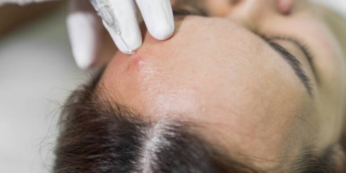 PRP Hair Treatment in Riyadh for Non-Surgical Hair Restoration Solutions