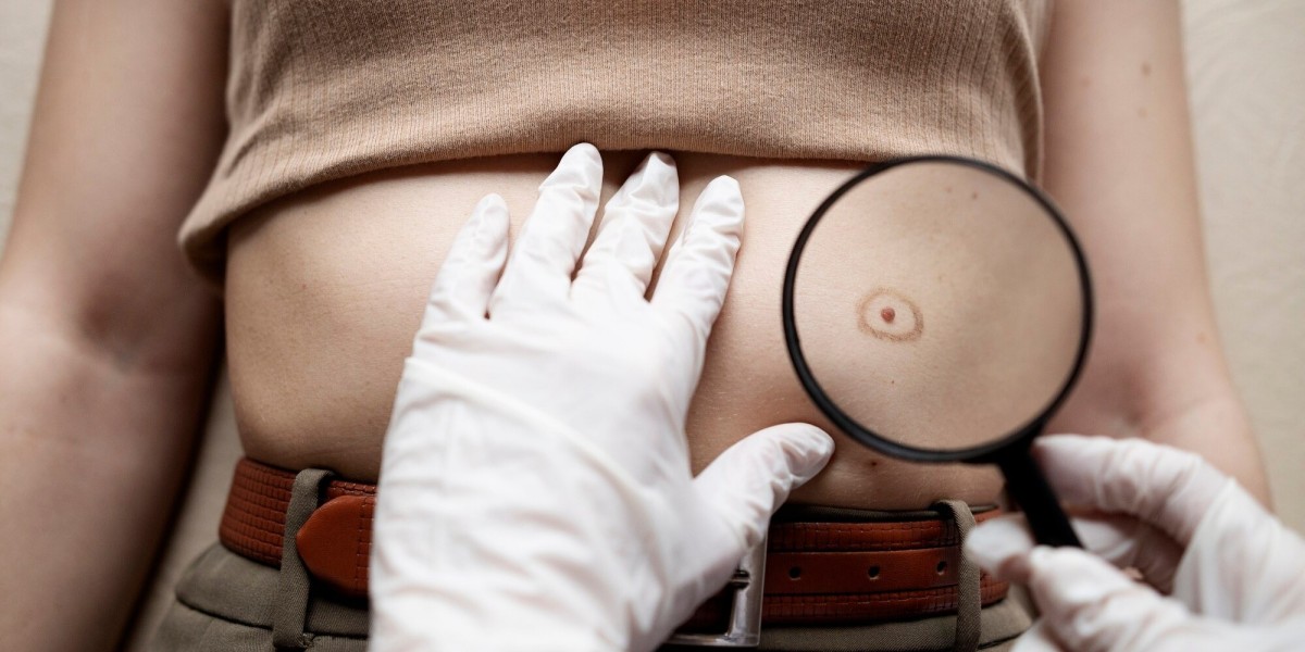Skin Cancer Specialist vs. General Dermatologist: Understanding the Difference