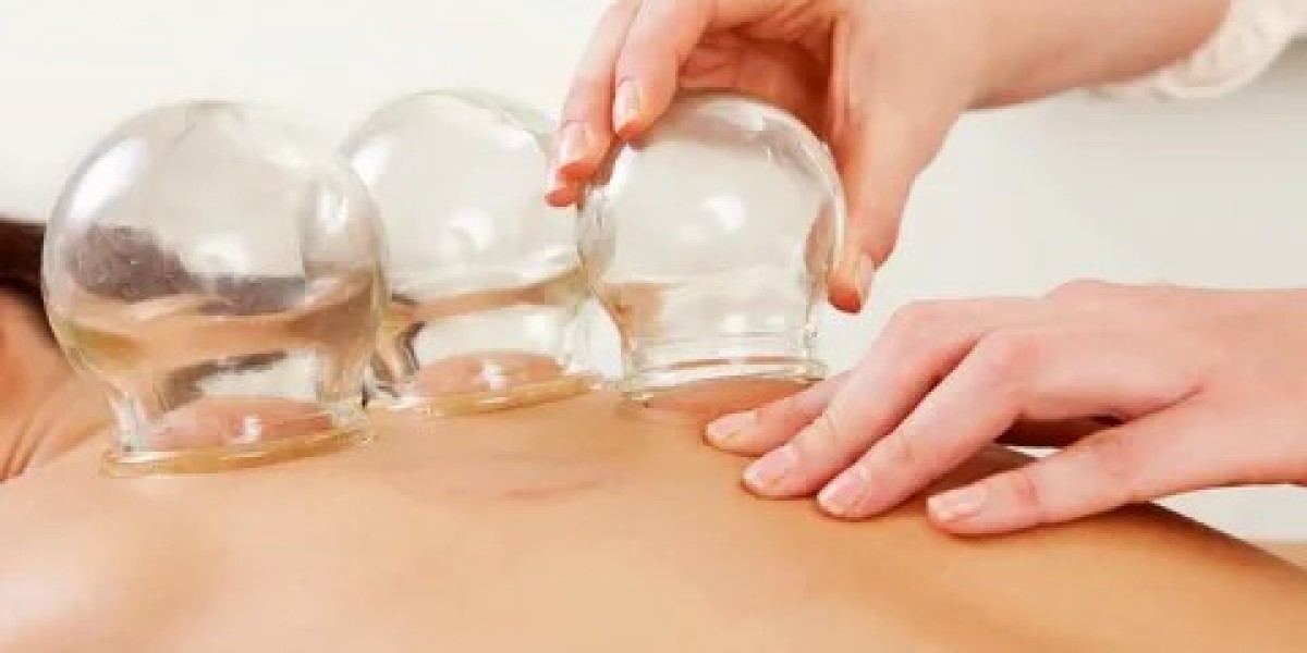 The Benefits of Cupping Therapy and How It Supports Better Health
