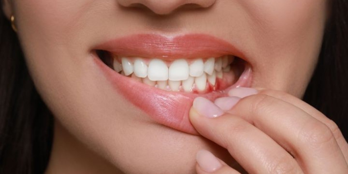 What Does a Hole in the Gum Mean After a Tooth Extraction?