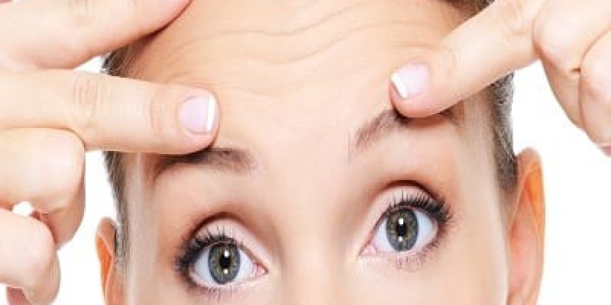 Forehead Lift Surgery in Dubai for Natural Appearance