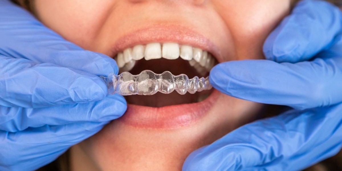 Can Teeth Move Back Without Dental Retainers?