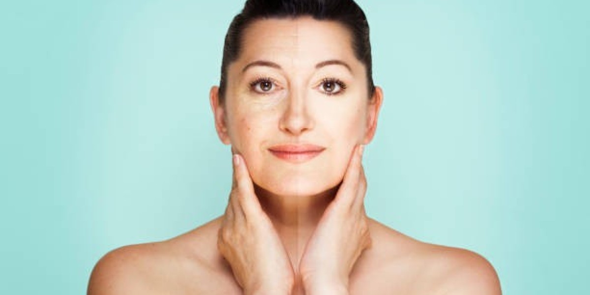 Neck Lift Surgery in Dubai: How to Get a Youthful Neck